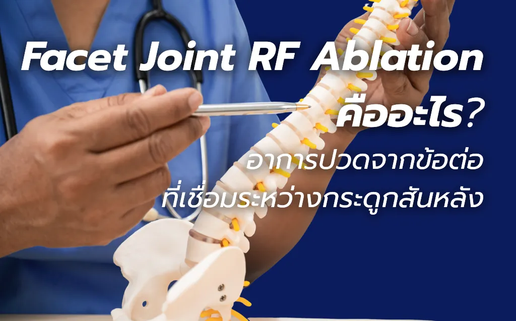 Facet Joint RF Ablation