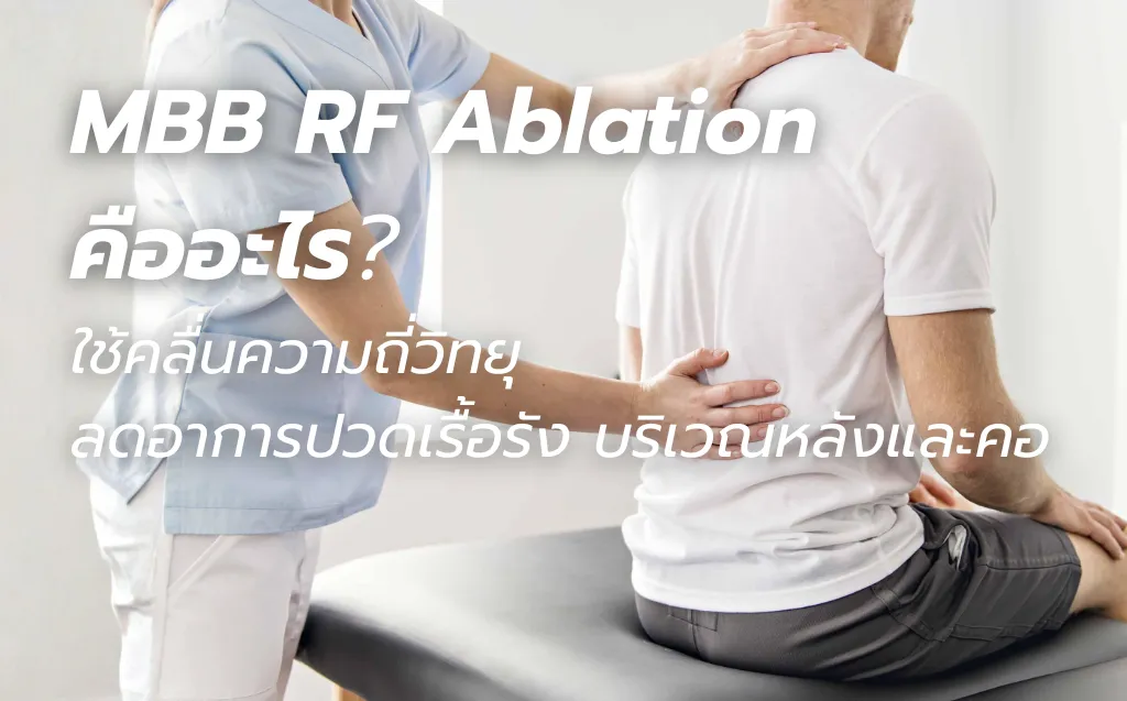 MBB RF Ablation