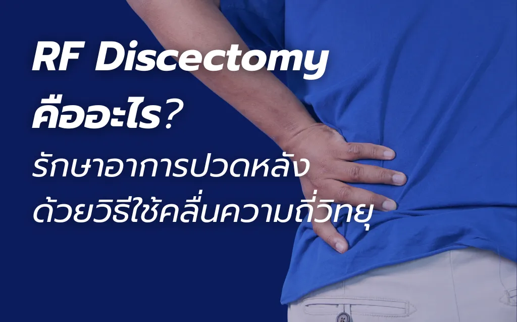 RF Discectomy (Radiofrequency Discectomy)